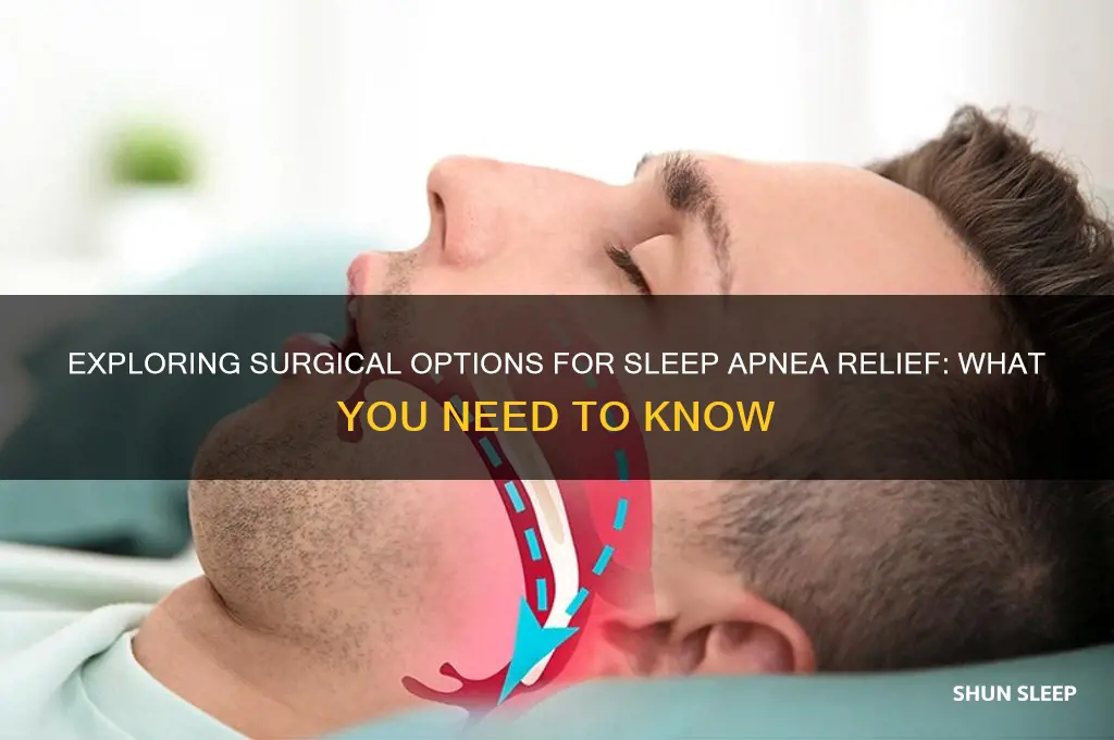 is there a surgery to help with sleep apnea
