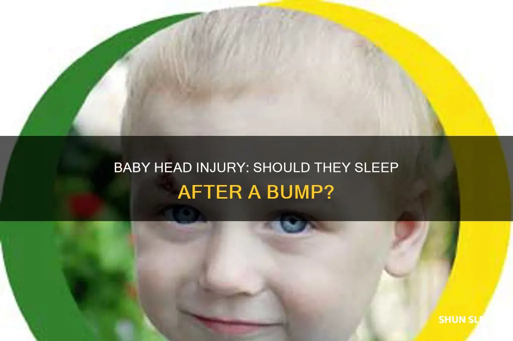 should a baby sleep after hitting their head