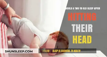 Head Injuries in Toddlers: Sleep or No Sleep?