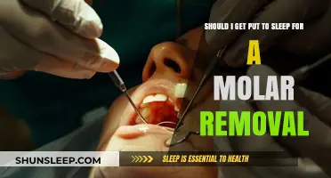 Molar Removal: Is General Anesthesia Necessary for Your Procedure?