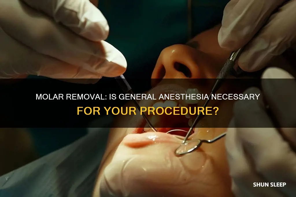 should i get put to sleep for a molar removal