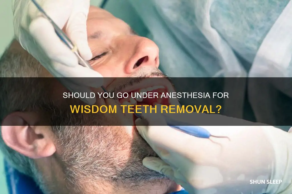 should i get put to sleep for wisdom teeth