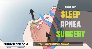 Should You Consider Sleep Apnea Surgery? Weighing the Pros and Cons