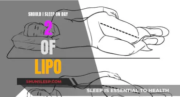 Resting After Lipo: Should You Sleep Through Recovery?