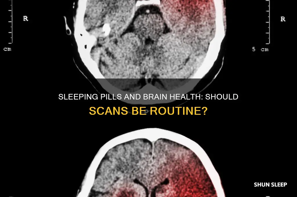 should people on sleeping medicine get brain scan