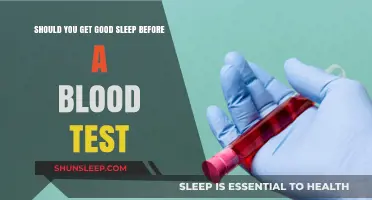 Sleep Before Blood Tests: Essential Prep or Overrated Myth?