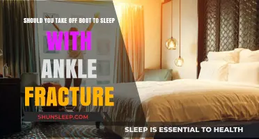 Boot Off or On: Ankle Fracture Sleep Guide