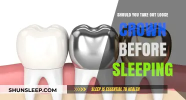 Should You Remove a Loose Crown Before Bed?