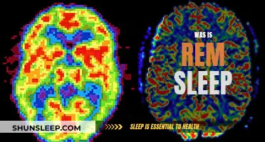 Understanding REM Sleep: What, Why, and How?