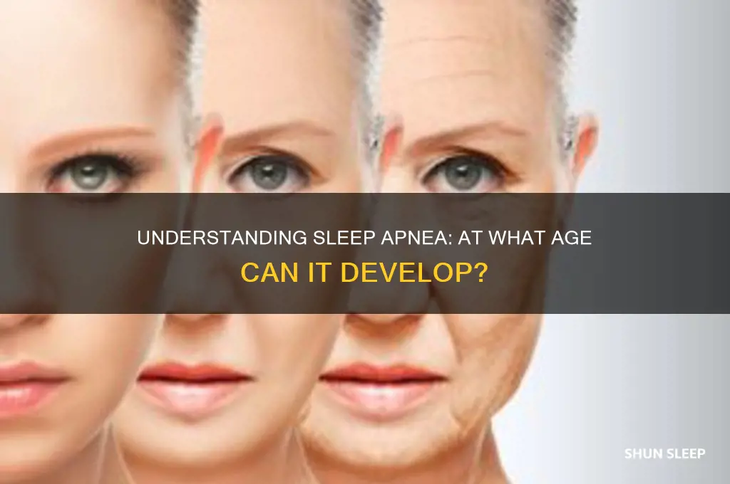 what age can u get sleep apnea