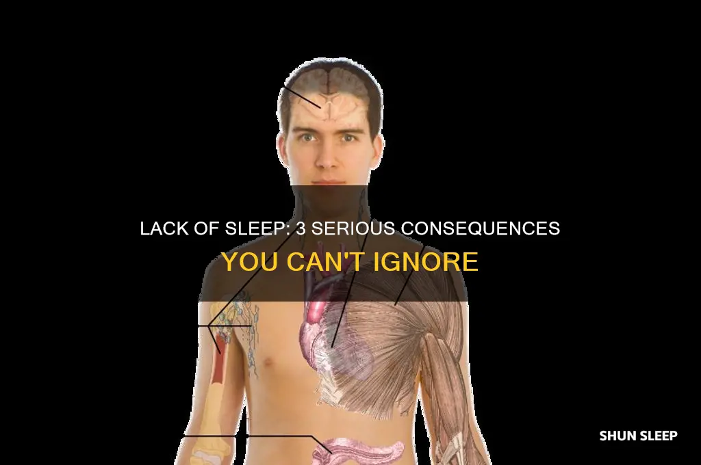 what are 3 consequences of not getting enough sleep
