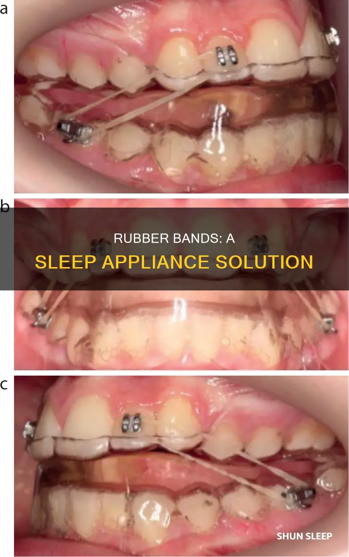 what are rubber bands used for sleep appliance