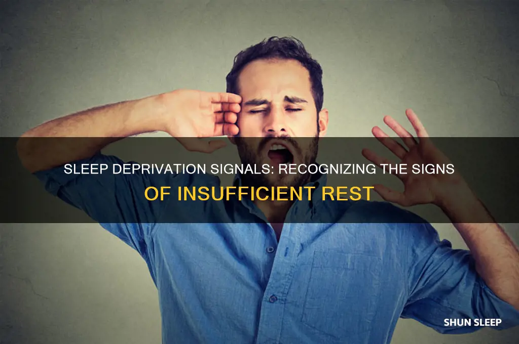 what are signs of not getting enough sleep