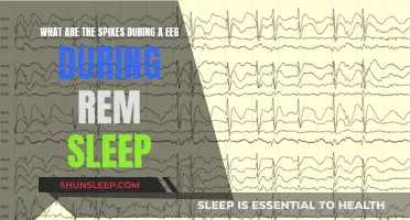 Brain Spikes During REM Sleep: Understanding EEG Readings