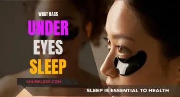 Sleep and eye bags: What's the connection?