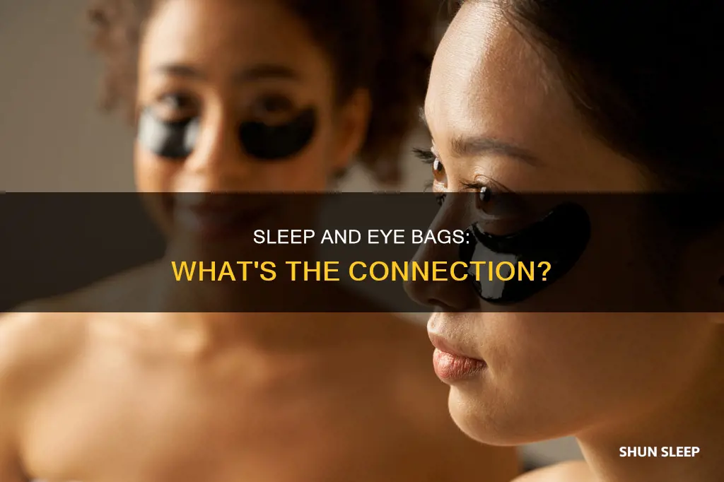 what bags under eyes sleep