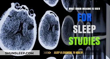 Brain Imaging Techniques for Sleep Studies Explained