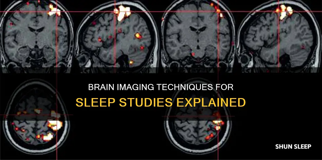 what brain imaging is used for sleep studies