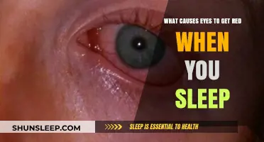 Why Do Eyes Turn Red After Sleeping? Common Causes Explained