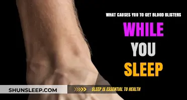 Why Blood Blisters Appear on Your Feet Overnight: Causes Explained