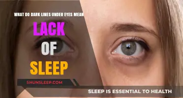 Dark Circles: Sleep Deprivation's Unwelcome Calling Card