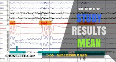 Understanding Sleep Study Results: What Do They Mean?