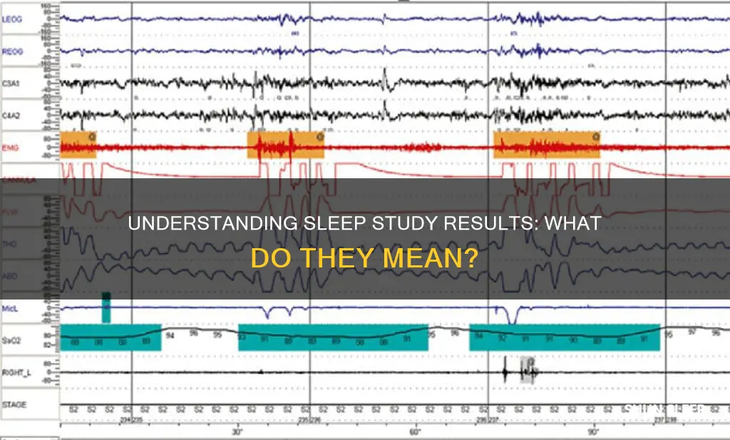 what do my sleep study results mean