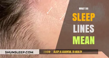 Sleep Lines: What Do They Mean for Your Health?