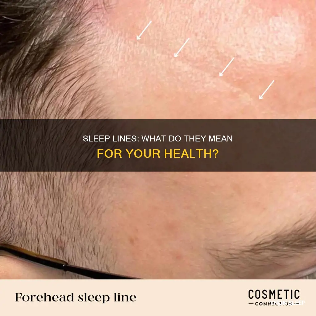 what do sleep lines mean