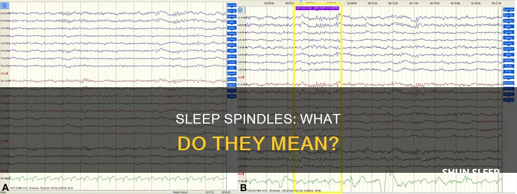 what do sleep spindles mean