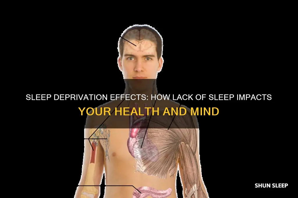 what do you get when you dont get enough sleep