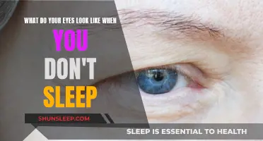 Sleep Deprivation: Eyes Give You Away