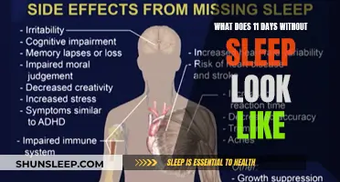 Sleep Deprivation: 11 Days Without Sleep