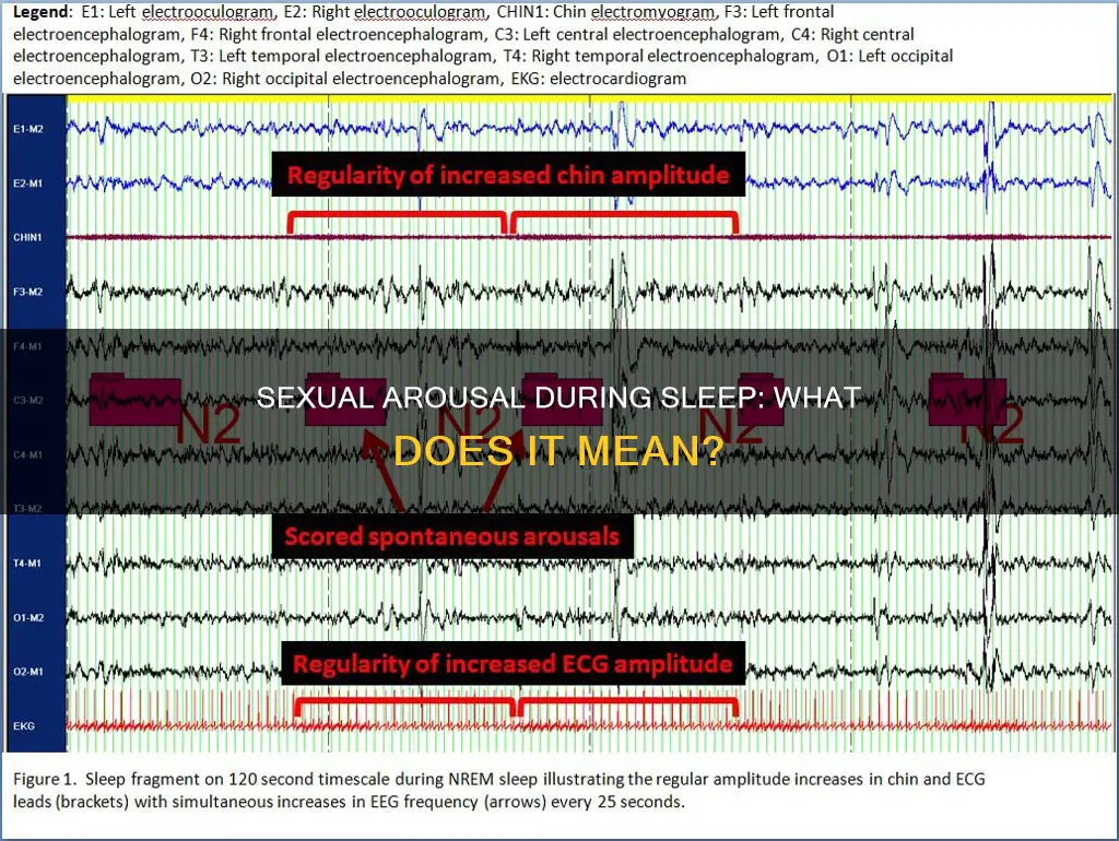 what does arousal during sleep mean