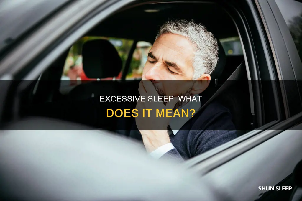 what does excessive sleep mean