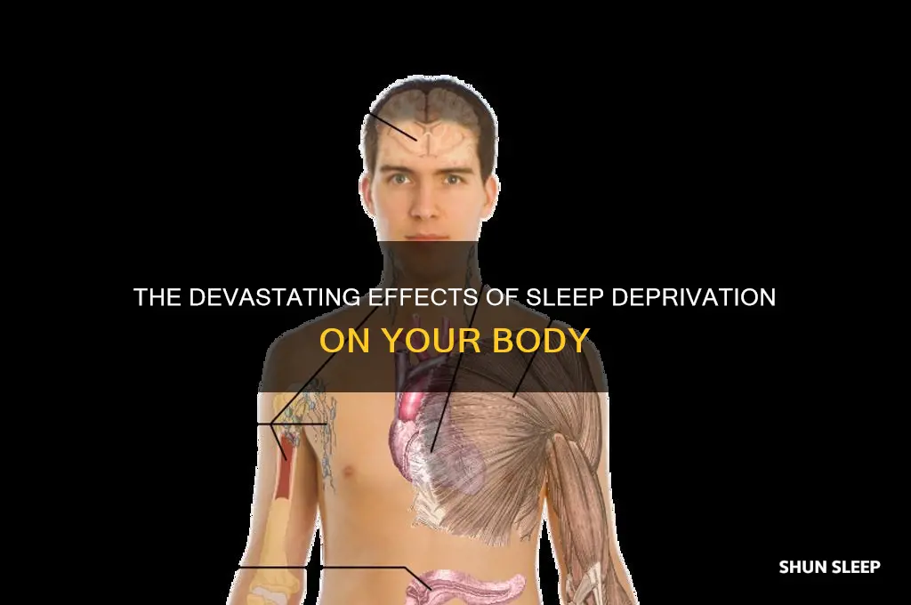 what does getting no sleep do to your body