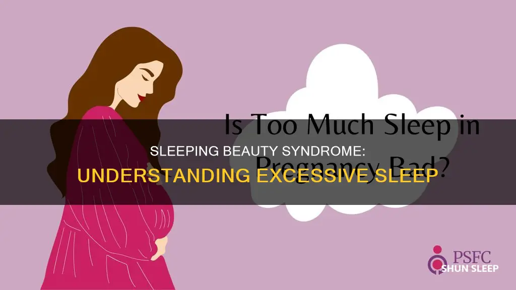 what does it mean if someone sleeps all the time