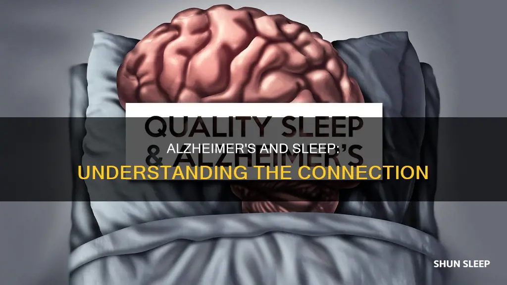 what does it mean when alzheimer