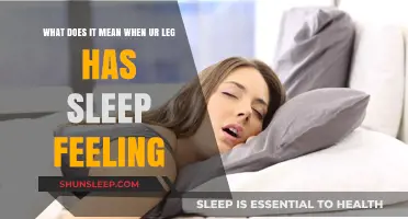 How to Wake Up a Sleeping Leg