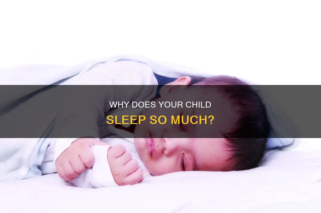 what does it mean when your child sleeps a lot