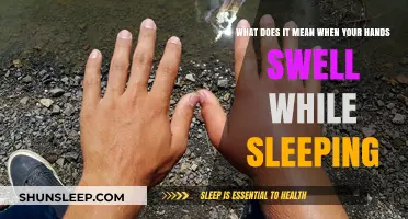 Swelling Hands: What Your Body is Trying to Tell You