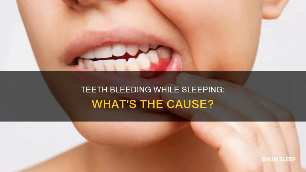 what does it mean when your teeth bleed while sleeping