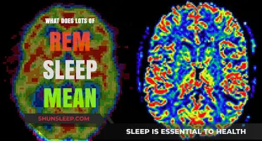 Why Do I Need So Much REM Sleep?