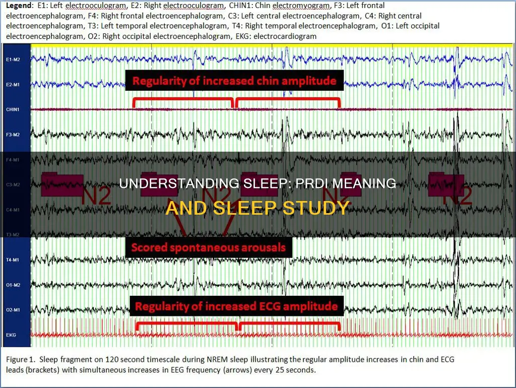 what does prdi mean in sleep study