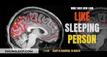 Understanding REM Sleep: What Does It Look Like?