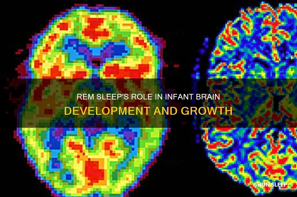 what does rem sleep help develop in infants