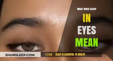Sleepy Eyes: What Does It Mean?