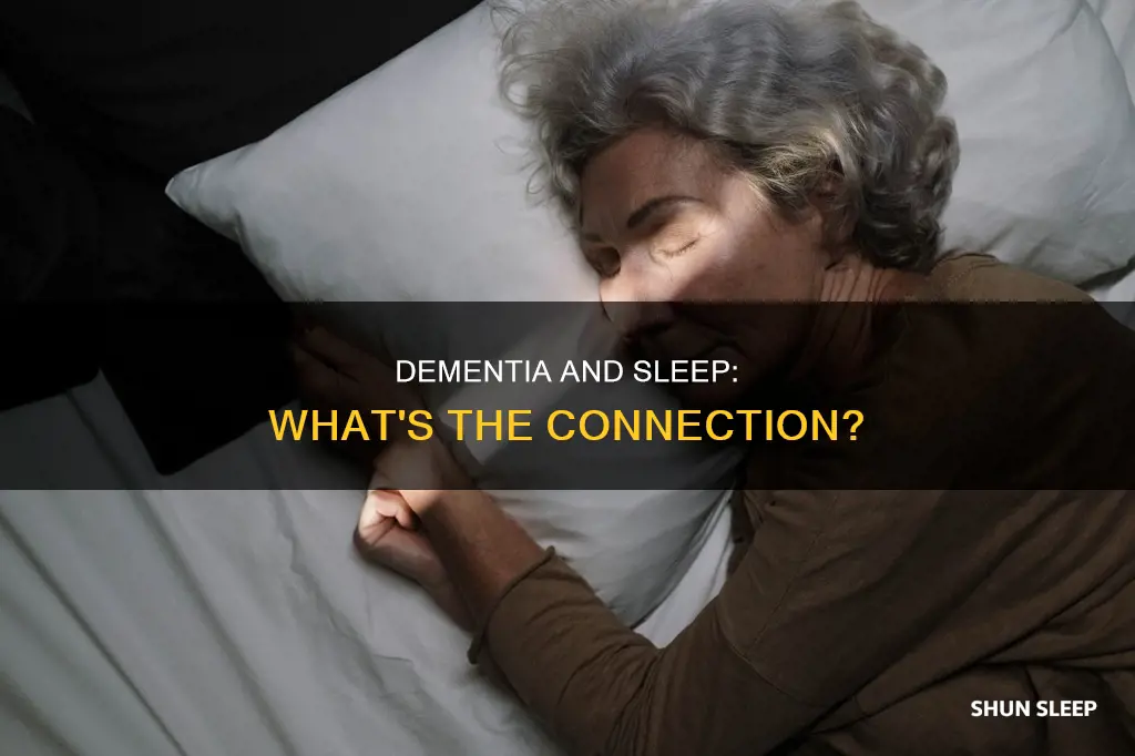 what does sleeping a lot with dementia mean