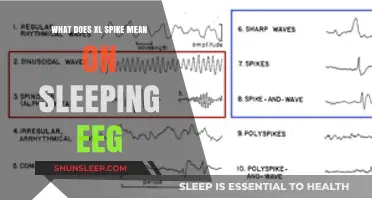 EEG Sleep Spikes: What Do They Mean?