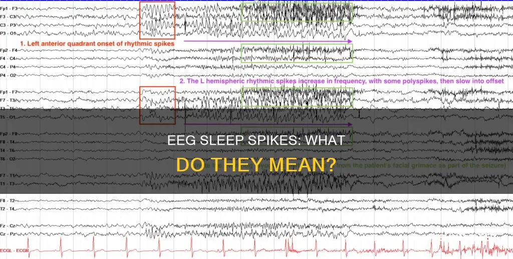 what does xl spike mean on sleeping eeg